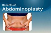 Tummy Tuck orange county - Benefits of Abdominoplasty