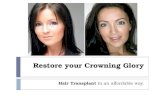 Hair transplant - Restore Your Crowning Glory