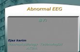 Abnormal EEG Patterns BY: Ejaz Karim Hunzai