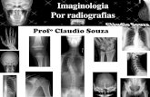 Aula 3- Imaginologia por radiografias, Joelho e perna. Profº Claudio Souza
