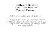 Healthcare Guide to Laser Treatment for Toenail Fungus
