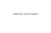 Uterine anomalies