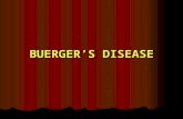 Buerger’s disease
