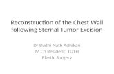 Chest Wall Reconstruction