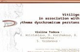 Vitiligo in association with Erythema dyschromicum perstans
