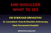 Shoulder Mri Scan in Delhi by Dr Shekhar Shrivastav