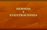 (05) Hernias y Eventraciones en Power Point