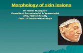 Morphology of skin lesions