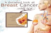 Breast Cancer Awareness Presentation - Learn How To Check For Breast Cancer