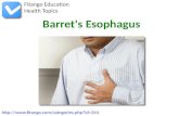 Barret's Esophagus