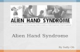 Alien hand syndrome