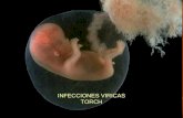 INFECCIONES VIRICAS TORCH. T T OXOPLASMOSIS O O TROS (VZV-PB19-...) R R UBEOLA C C ITOMEGALIA H H ERPES ABORTOS PREMATUREZ RCIU MUERTE FETAL PETEQUIAS.