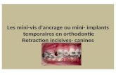 Les mini vis d'ancrage ou mini- implants  temporaires en orthodontie retraction incisives- canines
