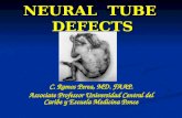 Neural tube defects