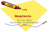 Neoplasia basics ! first lecture !