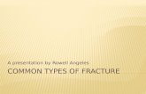 Common Types Of Fracture