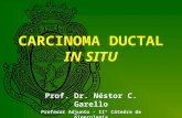 CARCINOMA DUCTAL IN SITU Prof. Dr. Néstor C. Garello Profesor Adjunto - IIº Cátedra de Ginecología Universidad Nacional de Córdoba - Argentina Prof. Dr.