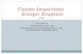 LECTURE 6 INGRID REED DDS, MS DEPARTMENT OF ORTHODONTICS AND DENTOFACIAL ORTHOPEDICS Canine Impactions Ectopic Eruption 1.