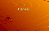 Hernia. Definition : Definition : A hernia is a protrusion of a viscus or a part of viscus through an abnormal opening in the walls of its containing.