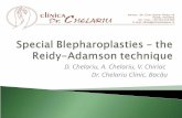 Special Blepharoplasties– the Reidy Adamson technique - Dr. Chelariu