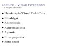 Lecture 7 Visual Perception (Dr Roger Newport) Hemianopia/Visual Field Cuts Blindsight u Akinetopsia u Achromatopsia u Agnosia Prosopagnosia Split Brain.