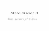 Stone disease 3 Open surgery of kidney 54. Surgical Management of Upper Urinary Tract Calculi 48 Kidney Calculi Pelolithotomy Nephrolithotomy Although.