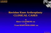 by Marc CLEMENS MD & Yvan BARTHOLOME MD Revision Knee Arthroplasty CLINICAL CASES LEGION Revision Knee System.