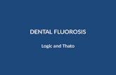 DENTAL FLUOROSIS Logic and Thato. DEFINITION Dental fluorosis is an enamel defect caused by an excessive intake of fluorides during the time of enamel.