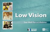 Is Vision Loss Part of Getting Older?  Vision can change as we age.  Vision loss and blindness are not a normal part of aging.