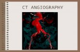 CT ANGIOGRAPHY. CT IMAGE OF THE BLOOD VESSEL OPACIFIED BY CONTRAST.