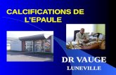 CALCIFICATIONS DE LEPAULE DR VAUGE LUNEVILLE. INTRODUCTION FREQUENTES = 3 à 5% population SVT ASYMPTOMATIQUE = 20% douloureuses ++ entre 30 et 40 ans,
