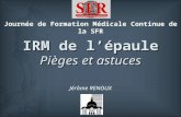 IRM de lépaule Pièges et astuces Jérôme RENOUX Journée de Formation Médicale Continue de la SFR.