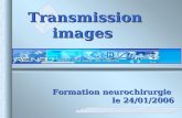 . Transmission images Formation neurochirurgie le 24/01/2006.