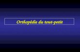 Orthopédie du tout-petit. LCH Gros bébé Siège ATCD familiaux Anomalies orthopédiques associées Pied bot, torticolis congénital… LCH : Facteurs de.