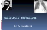 RADIOLOGIE THORACIQUE Dr A. Cavalleri. Plusieurs possibilités sont offertes pour explorer radiologiquement le thorax le cliché de face et de profil la.