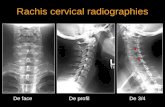 Rachis cervical radiographies De face De profil De 3/4 *