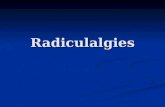 Radiculalgies. Radiculalgie = douleur due à atteinte racine nerveuse En pratique, 2 situations cliniques Radiculalgies MI Radiculalgies MS Lombosciatique.