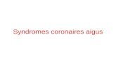 Syndromes coronaires aigus. généralités Les S.C.A regroupent langor instable et lI.D.M S.C.A: Douleur thoracique dallure angineuse survenant de novo,