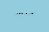 Cancer du côlon. Épidémiologie 1 C'est le second cancer, en terme de fréquence, chez la femme (après le cancer du sein) et le troisième chez l'homme (après.