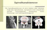 Spinalkanalstenose Die Spinalkanalstenose ist eine relative oder absolute Enge des Spinalkanals. Symptome einer Claudicatio spinalis (neurologische Symptome)