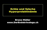 Echte und falsche Hyperprolaktinämie Bruno Müller .