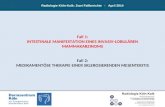 Radiologie Köln-Kalk: Zwei Fallberichte - April 2014 Fall 1: INTESTINALE MANIFESTATION EINES INVASIV-LOBULÄREN MAMMAKARZINOMS Fall 2: MEDIKAMENTÖSE THERAPIE.