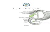 Calculous Cholecystitis