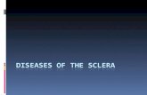 Diseases of the Sclera
