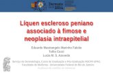 Eduardo Mastrangelo Marinho Falcão Tullia Cuzzi Lucia M. S. Azevedo Líquen escleroso peniano associado à fimose e neoplasia intraepitelial Líquen escleroso.