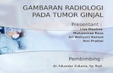 Radio Tumor Ginjal