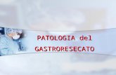 PATOLOGIA del GASTRORESECATO. RESEZIONE GASTRICA BILLROTH I BILLROTH II ANSA ALLA ROUX.
