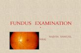 Fundus examination