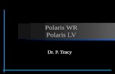 Dr Patrick Treacy discusses the Syneron Polaris RF Laser