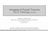 Imaging Of Facial Trauma Part 3